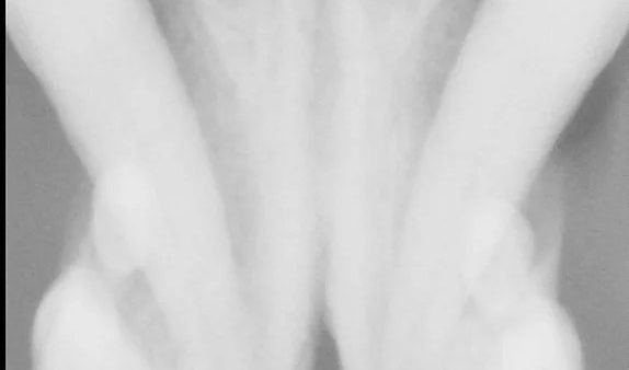 Case #012: 犬　歯周病の309のヘミセクション