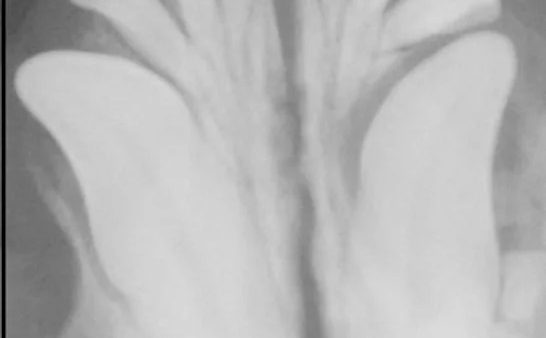 Case #050: 左下顎犬歯(304)、第１前臼歯(305)の含歯性嚢胞のフレンチブルドッグ